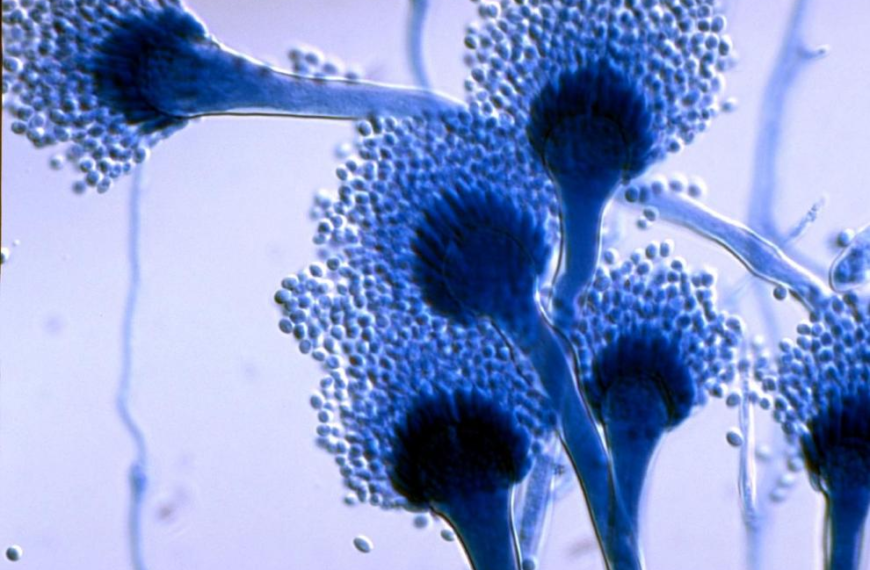 Hospital El Pino y hongo Aspergillus: Medidas urgentes